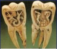 Fanom - robak w zębie (rzeźba z kości słoniowej z południowej Francji, 1780) przez tysiąclecia budzący strach.